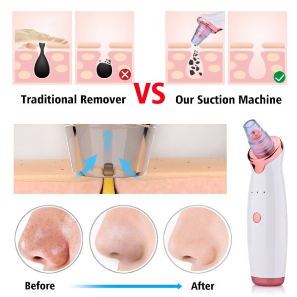 Blackhead Instrument Electric Suction Facial Washing Instrument Beauty Acne Cleaning Blackhead Suction Instrument - Image 8