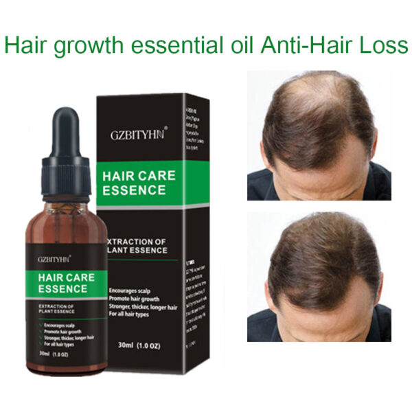 Hair Growth Oil Hair Growth Oil Oem Hair Care Essential Oil - Image 5
