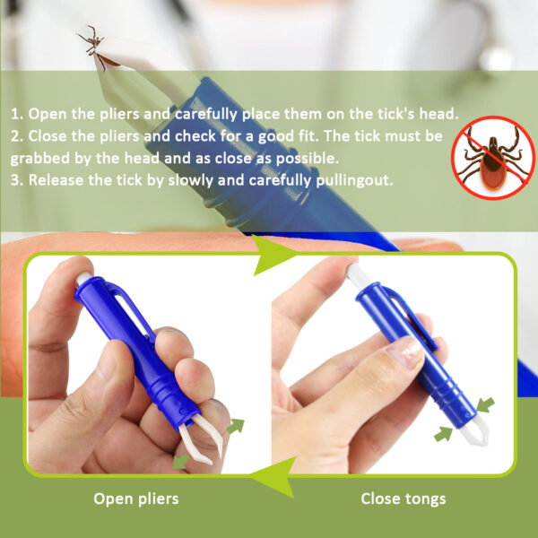 Tick Remover Tool For Dogs - Painlessly Tick Remover For Humans And Cats Pets, 3 Pcs - Image 10